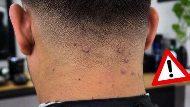 Navajas, tijeras y otros utensilios de peluquería que deben desinfectarse ante el riesgo de lesiones cutáneas por VPH