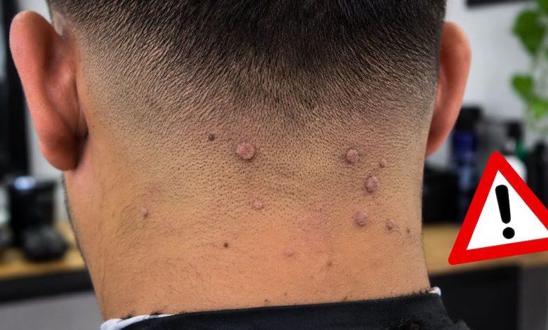 Navajas, tijeras y otros utensilios de peluquería que deben desinfectarse ante el riesgo de lesiones cutáneas por VPH