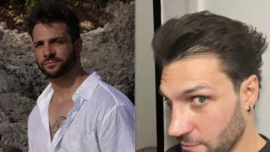 Nicola Porcella durante el video en el que mostró su nuevo peinado y los cambios visibles en su rostro